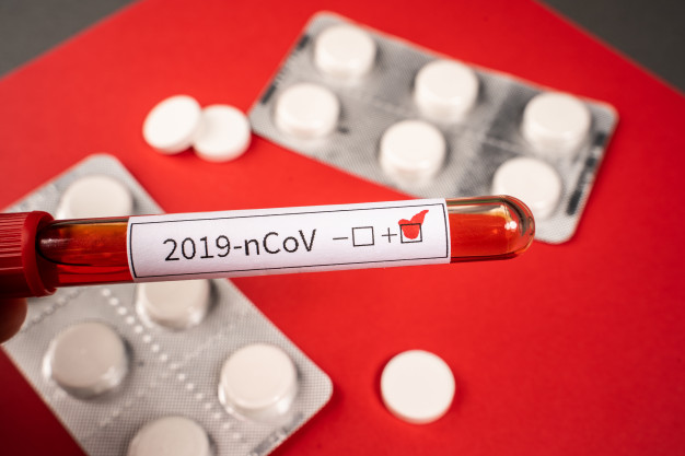 Región Caribe registra este lunes 1.499 nuevos casos de Covid-19