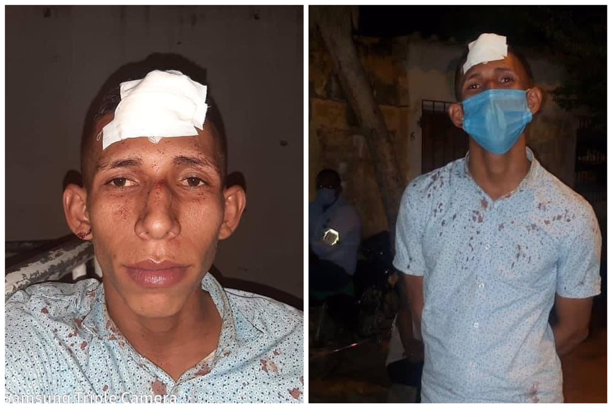 (En video) ‘Candela’ se llevó un ‘cilindrazo’ al intentar atracar a unos trabajadores en Cartagena