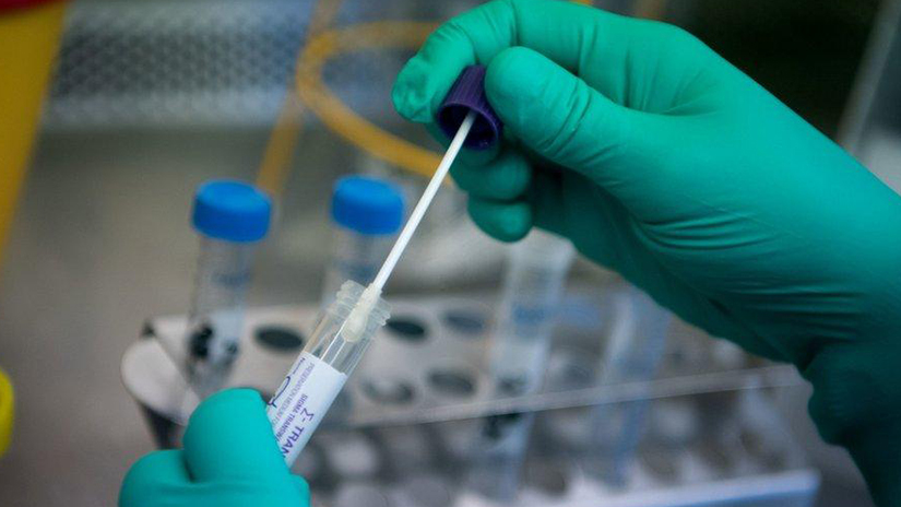 Minsalud reporta 18.650 nuevos casos y 509 fallecidos de Covid-19