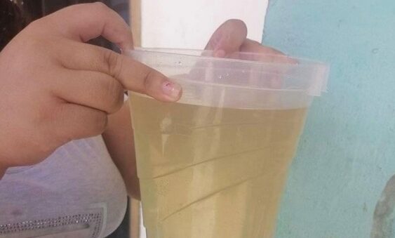 Siguen quejas por turbiedad del agua en los barrios de Barranquilla