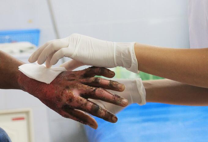 371 personas lesionadas con pólvora en lo corrido de diciembre