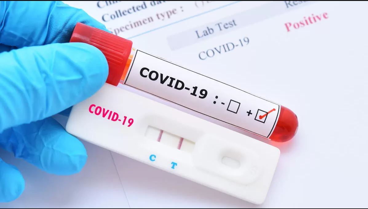 Covid-19 en Colombia: 301 nuevos contagios y 10 fallecidos