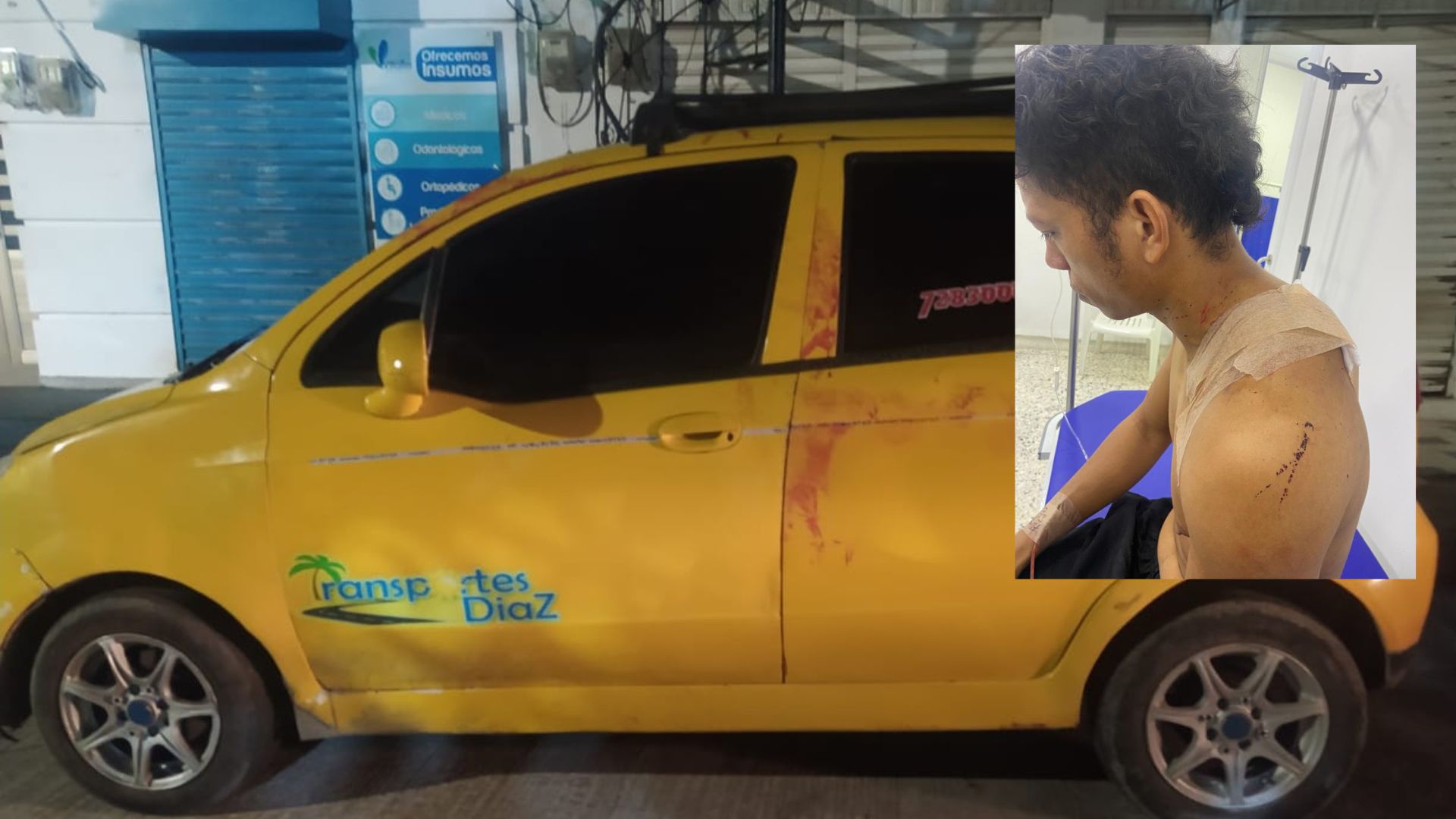 Taxista en Riohacha fue golpeado y herido con un destornillador por oponerse a llevar borrachos