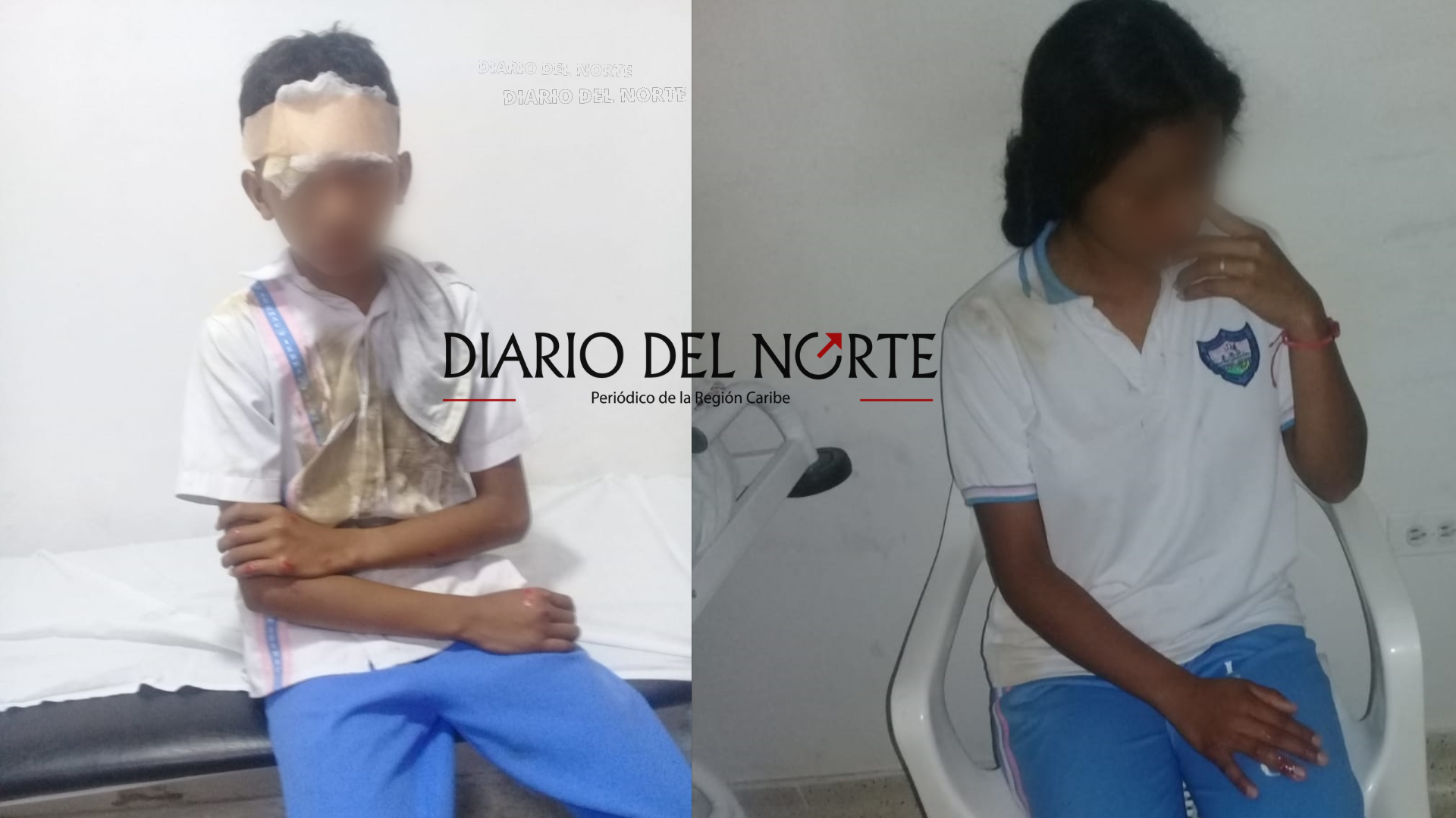 Por falta de transporte escolar estudiantes resultaron heridos en accidente de tránsito en zona rural de Albania