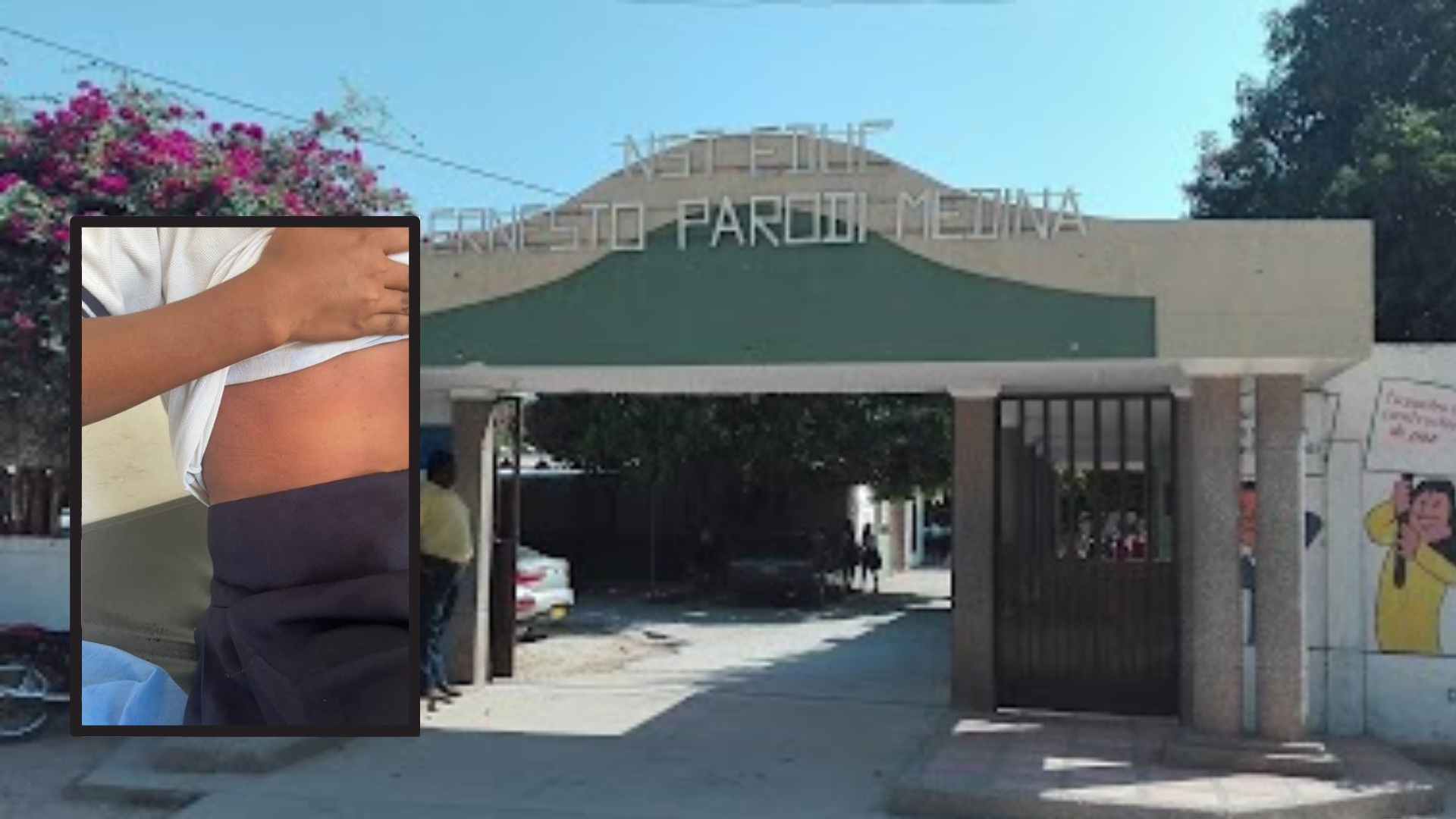 Emergencia en colegio de Fonseca: Ataque de abejas africanas pone en peligro a estudiantes