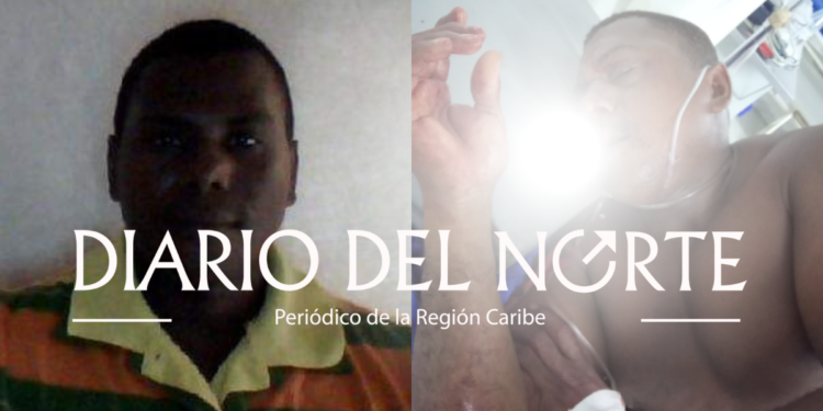 Vigilante quedó herido al chocar su moto con un tractocamión en Mingueo