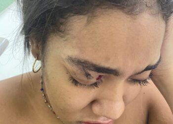 “El nivel de inseguridad en Riohacha crece cada día”, denunció el acordeonero Edwin Díaz Molina