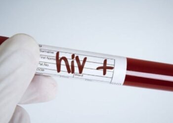 Alerta por aumento de casos de VIH en América Latina según Onusida