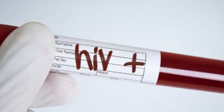 Alerta por aumento de casos de VIH en América Latina según Onusida