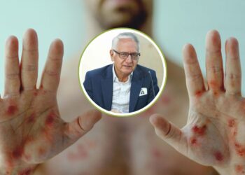 Colombia refuerza vigilancia ante declaratoria de Emergencia Internacional por variante Mpox clado I