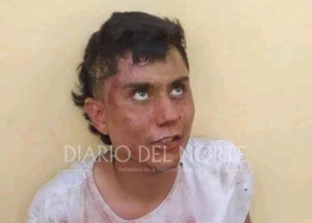 La comunidad del barrio San Francisco detienen y le dan una golpiza a un presunto ladrón