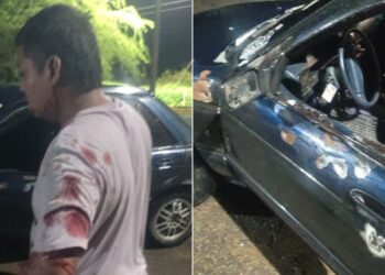 Conductor resultó herido a bala por atracadores en la vía Albania – Maicao