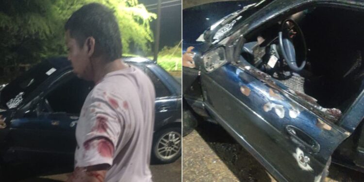 Conductor resultó herido a bala por atracadores en la vía Albania – Maicao