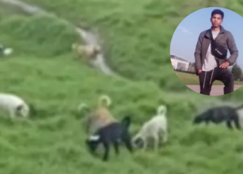 Joven pierde ambos brazos tras feroz ataque de perros callejeros en Bogotá