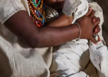 Bebé indígena sufre graves quemaduras y es trasladada de urgencia a Valledupar