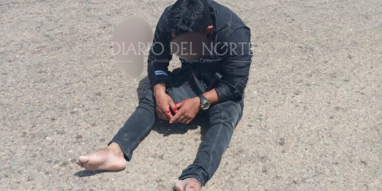 Joven wayuú resultó herido en un accidente de tránsito en la vía Uribia – Maicao