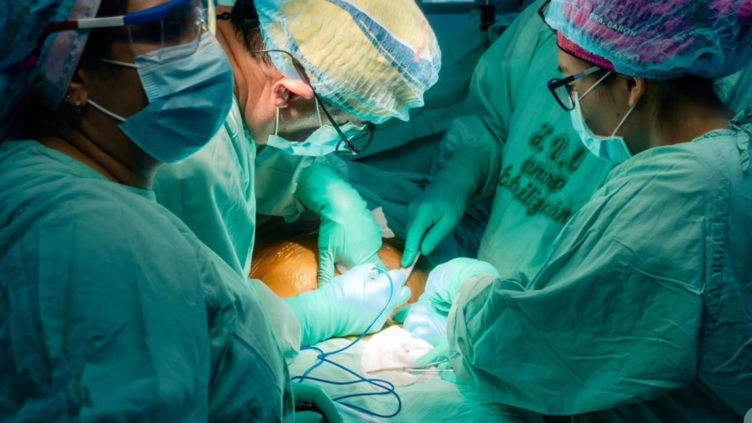 Primera cirugía fetal de alta complejidad se realiza con éxito en San Juan del Cesar