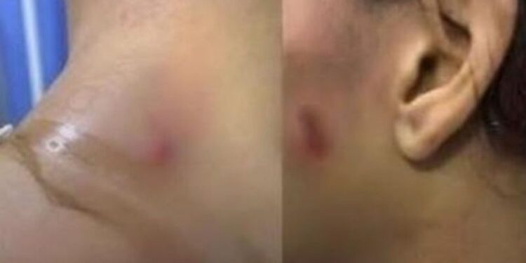 Joven de 18 años fue atacada con pico de botella tras resistirse a un intento de abuso sexual en Santa Marta