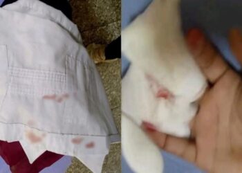 Menor de 7 años resultó gravemente herido en escuela de Manaure; podría perder dos dedos