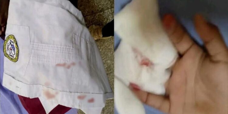 Menor de 7 años resultó gravemente herido en escuela de Manaure; podría perder dos dedos