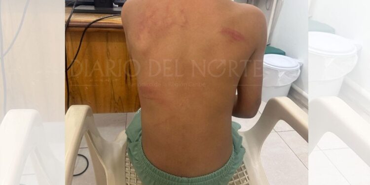 En El Molino, fue capturada una mujer por maltrato a su hijo menor de ocho años