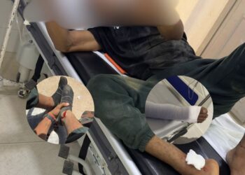 Joven resultó herido al caer en obras del alcantarillado en el barrio El Carmen de Fonseca