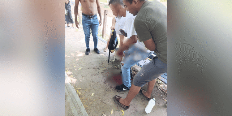 Hombre resultó herido en presunto intento de atraco en el barrio El Pilar de Barrancas