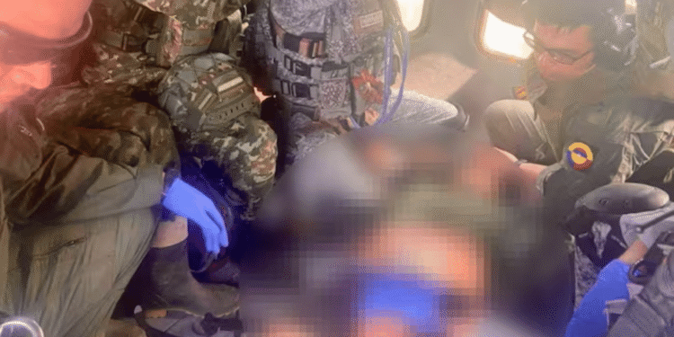 Dos hombres heridos tras pisar mina antipersonal en Anorí: uno sufrió amputación