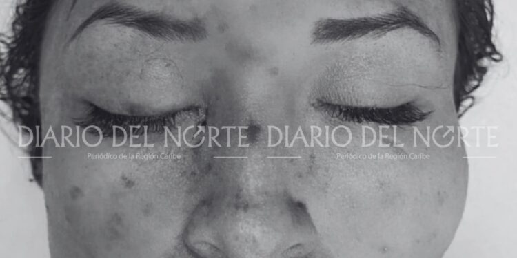 Mujer hallada sin vida en la vía Maicao–Riohacha permanece sin identificar