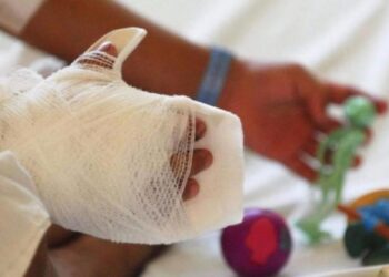 INS reporta 134 nuevos lesionados por pólvora en Navidad; 39 son niños y adolescentes