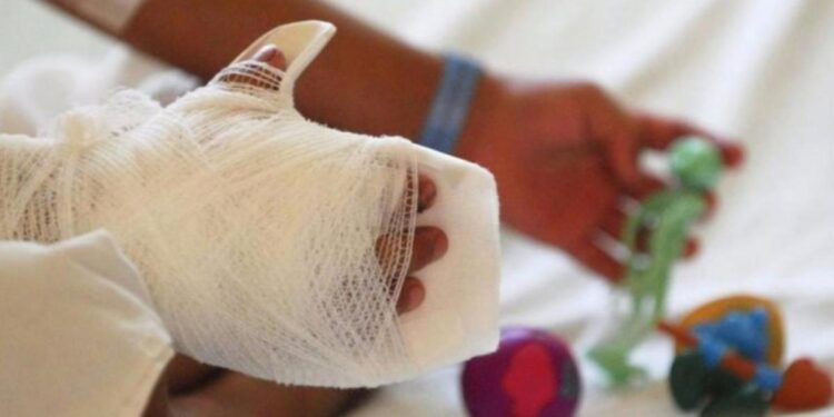 INS reporta 134 nuevos lesionados por pólvora en Navidad; 39 son niños y adolescentes