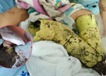 Menor de dos años fue rescatada tras quedar atrapada en un tubo de desagüe en Barrancas