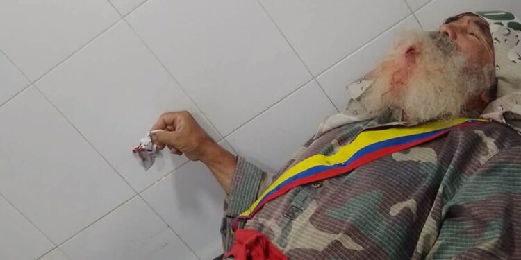 Indignación en Fonseca: Jóvenes hieren a adulto mayor tras hacerles un llamado por conducta indebida en vía pública