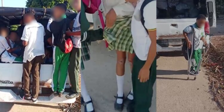 Estudiante resulta herida tras caer de camioneta mientras se dirigía a clases en el corregimiento de Tomarrazón