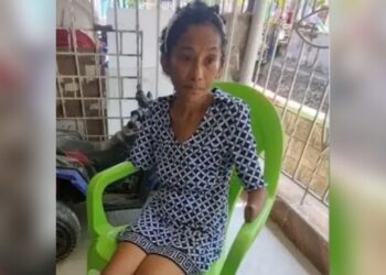 Mujer que ingresó a urgencias por fiebre en Barranquilla sufrió amputación de sus extremidades