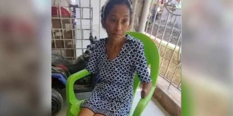 Mujer que ingresó a urgencias por fiebre en Barranquilla sufrió amputación de sus extremidades