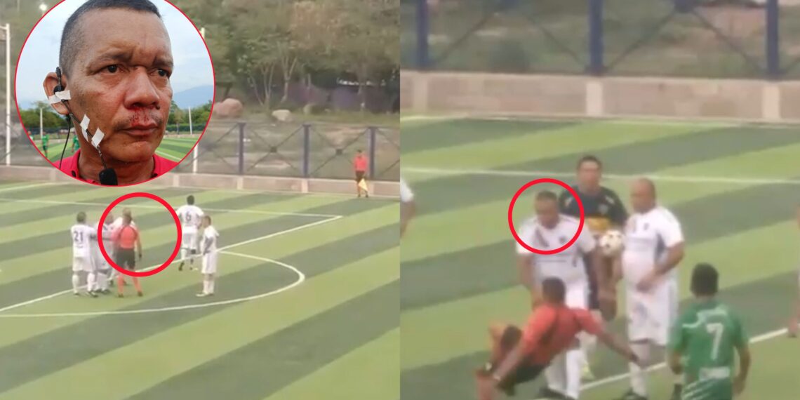 Hecho de violencia en partido entre Habilidades y Urumita FC deja árbitro lesionado en Villanueva