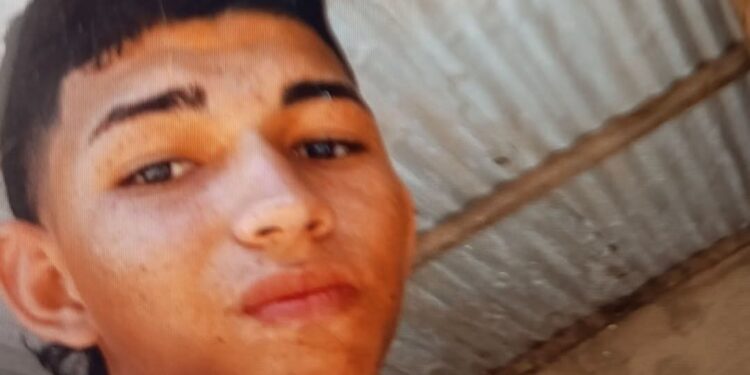 Adolescente resulta gravemente herido en accidente de tránsito en Fonseca